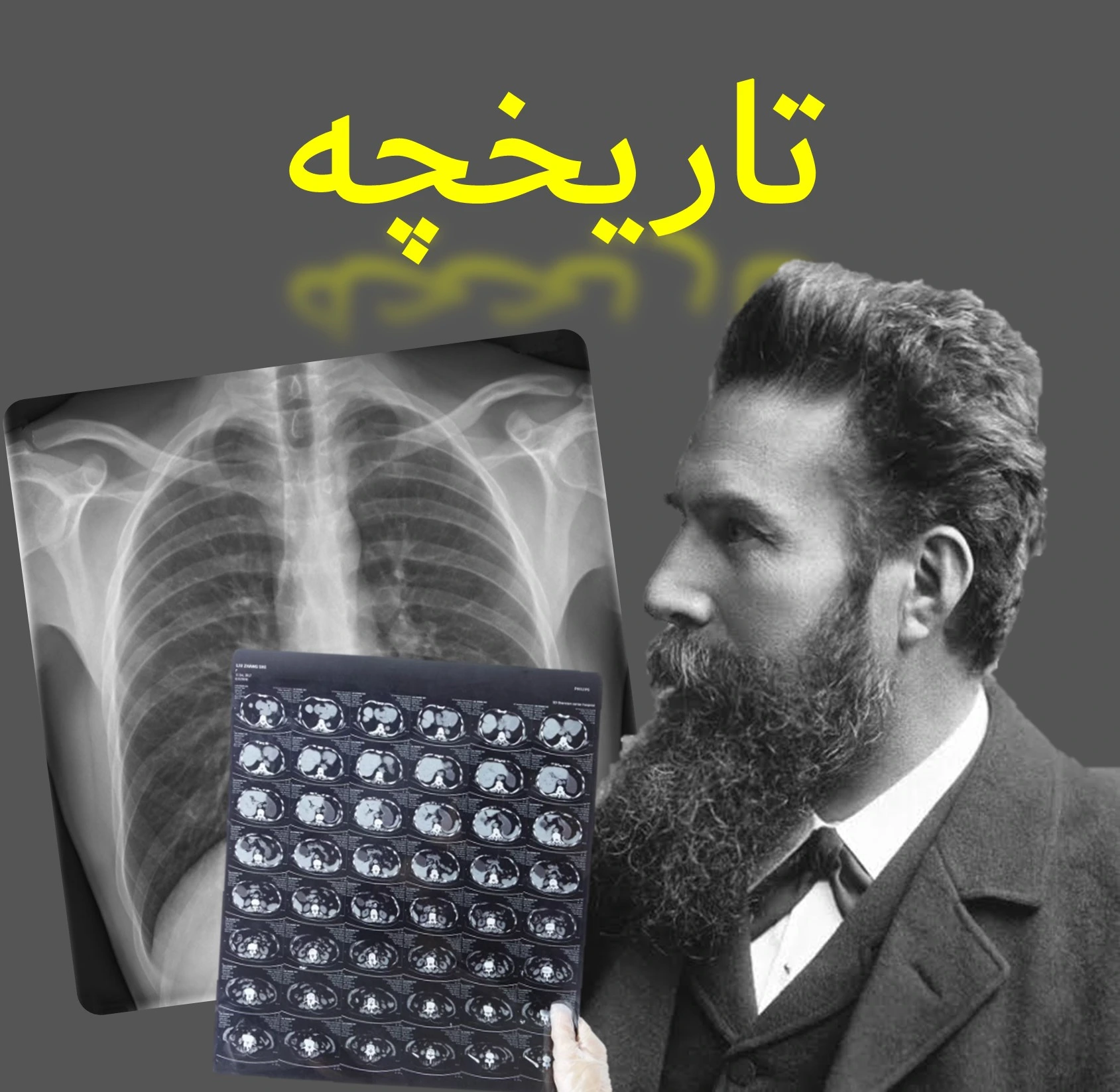 تاریخچه و نقش پررنگ رادیولوژی در پزشکی مدرن